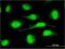 Origin Recognition Complex Subunit 6 antibody, H00023594-M04, Novus Biologicals, Immunocytochemistry image 