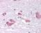 Melanin Concentrating Hormone Receptor 1 antibody, 48-128, ProSci, Immunohistochemistry paraffin image 