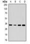 Aldo-Keto Reductase Family 7 Member A3 antibody, abx141462, Abbexa, Western Blot image 