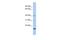 Zinc Finger Protein 396 antibody, A13687, Boster Biological Technology, Western Blot image 