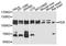 FER Tyrosine Kinase antibody, A9687, ABclonal Technology, Western Blot image 