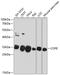 Coatomer Protein Complex Subunit Epsilon antibody, GTX64942, GeneTex, Western Blot image 