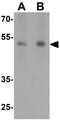 NK3R antibody, GTX31316, GeneTex, Western Blot image 