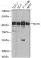 Actinin Alpha 1 antibody, GTX55505, GeneTex, Western Blot image 