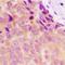 Killer Cell Lectin Like Receptor C1 antibody, orb315585, Biorbyt, Immunohistochemistry paraffin image 