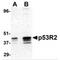 Ribonucleotide Reductase Regulatory TP53 Inducible Subunit M2B antibody, MBS150957, MyBioSource, Western Blot image 