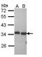 Peroxisomal trans-2-enoyl-CoA reductase antibody, GTX112083, GeneTex, Western Blot image 