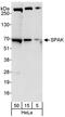 Serine/Threonine Kinase 39 antibody, A302-465A, Bethyl Labs, Western Blot image 