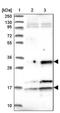 Centromere Protein V antibody, PA5-60014, Invitrogen Antibodies, Western Blot image 