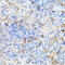 Chromatin assembly factor 1 subunit B antibody, 22-090, ProSci, Immunohistochemistry paraffin image 