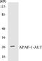 Apoptotic Peptidase Activating Factor 1 antibody, EKC1033, Boster Biological Technology, Western Blot image 