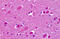Cadherin EGF LAG seven-pass G-type receptor 2 antibody, MBS244572, MyBioSource, Immunohistochemistry frozen image 