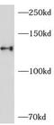Janus Kinase 2 antibody, FNab04432, FineTest, Western Blot image 