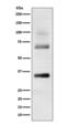 Loricrin antibody, M05290, Boster Biological Technology, Western Blot image 