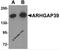 Rho GTPase Activating Protein 39 antibody, 6445, ProSci, Western Blot image 