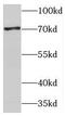 Protein TBRG4 antibody, FNab08533, FineTest, Western Blot image 
