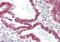 Ribonuclease H1 antibody, ARP40434_P050, Aviva Systems Biology, Immunohistochemistry paraffin image 