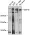 Microtubule Associated Protein 1B antibody, 19-029, ProSci, Western Blot image 