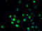 ARV1 Homolog, Fatty Acid Homeostasis Modulator antibody, A51277-100, Epigentek, Immunofluorescence image 