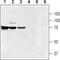 Solute Carrier Family 47 Member 1 antibody, GTX03645, GeneTex, Western Blot image 