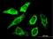 Solute Carrier Family 25 Member 3 antibody, H00005250-B02P, Novus Biologicals, Immunofluorescence image 