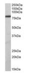 Zinc Finger And BTB Domain Containing 24 antibody, orb12265, Biorbyt, Western Blot image 