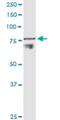 ADAM Metallopeptidase Domain 11 antibody, H00004185-M01, Novus Biologicals, Western Blot image 