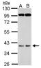 F-Box Protein 28 antibody, NBP2-16448, Novus Biologicals, Western Blot image 