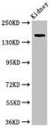 Ubiquitin carboxyl-terminal hydrolase 6 antibody, CSB-PA025747LA01HU, Cusabio, Western Blot image 