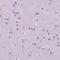 Zinc Finger Protein 853 antibody, PA5-64337, Invitrogen Antibodies, Immunohistochemistry paraffin image 