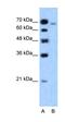 Afadin, Adherens Junction Formation Factor antibody, orb329765, Biorbyt, Western Blot image 