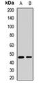 Sestrin 3 antibody, LS-C668987, Lifespan Biosciences, Western Blot image 