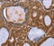 NADH:Ubiquinone Oxidoreductase Subunit A2 antibody, MBS2521861, MyBioSource, Immunohistochemistry paraffin image 