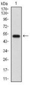 Gamma-Aminobutyric Acid Type B Receptor Subunit 2 antibody, NBP2-37280, Novus Biologicals, Western Blot image 