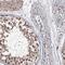 Ring Finger Protein 44 antibody, PA5-58621, Invitrogen Antibodies, Immunohistochemistry frozen image 