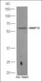 Melanocyte Inducing Transcription Factor antibody, orb13577, Biorbyt, Western Blot image 