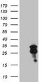 O-6-Methylguanine-DNA Methyltransferase antibody, TA809195S, Origene, Western Blot image 
