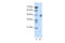 Zinc finger protein 271 antibody, 28-359, ProSci, Enzyme Linked Immunosorbent Assay image 