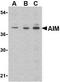 CD5 Molecule Like antibody, GTX41904, GeneTex, Western Blot image 