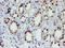 Zinc finger protein SNAI2 antibody, M01615-1, Boster Biological Technology, Immunohistochemistry paraffin image 