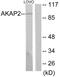 A-Kinase Anchoring Protein 2 antibody, GTX87891, GeneTex, Western Blot image 