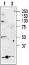 P2X purinoceptor 5 antibody, TA328995, Origene, Western Blot image 