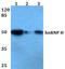 Heterogeneous nuclear ribonucleoprotein H2 antibody, A07741-1, Boster Biological Technology, Western Blot image 