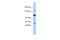 U2 SnRNP Associated SURP Domain Containing antibody, 25-678, ProSci, Western Blot image 