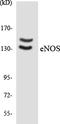 Nitric Oxide Synthase 3 antibody, EKC1929, Boster Biological Technology, Western Blot image 