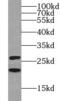 Myosin light chain 3 antibody, FNab05487, FineTest, Western Blot image 