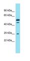 DC-STAMP Domain Containing 2 antibody, orb326967, Biorbyt, Western Blot image 