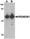 Kringle Containing Transmembrane Protein 1 antibody, TA320040, Origene, Western Blot image 