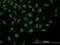 Zinc Fingers And Homeoboxes 2 antibody, H00022882-M01, Novus Biologicals, Immunofluorescence image 