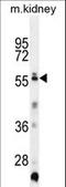 Tripartite Motif Family Like 1 antibody, LS-C160214, Lifespan Biosciences, Western Blot image 